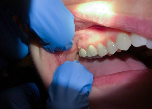Best Weekend Emergency Dentist in Melcher Dallas, IA
