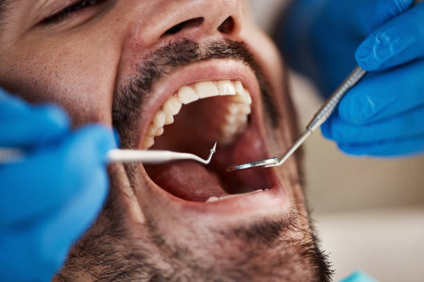 Best Emergency Treatment for Toothache in Melcher Dallas, IA