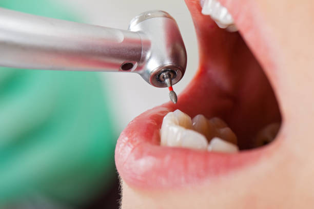 Best Emergency Broken Tooth Repair in Melcher Dallas, IA